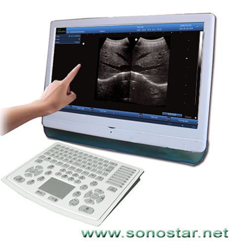 Ss 4 Touch Screen Lcd Ultrasound Scanner Manufacturer From China Sonostar Technologie Co Limited