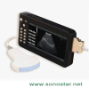 UPad-2 Tablet Palm Ultrasound B Scanner