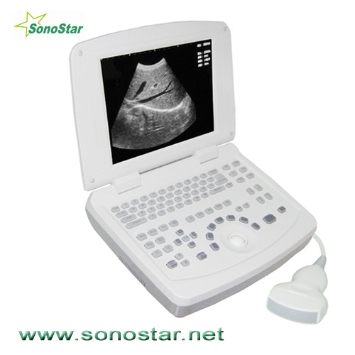SS-3 Laptop Ultrasound B Scanner