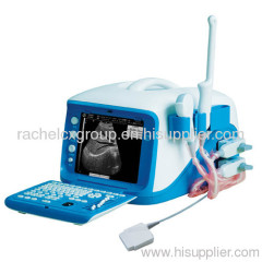 Portable Digital Ultrasound Scanner