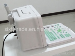 2012 Full-Digital Ultrasonic Diagnostic Apparatus DW360