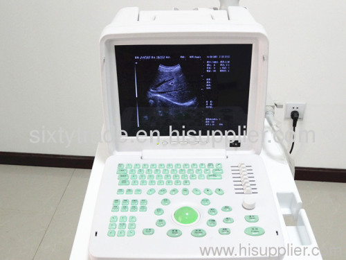 Full-Digital Ultrasonic Diagnostic Apparatus DW360 2012
