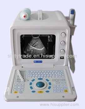 2012 Full-Digital Ultrasonic Diagnostic Apparatus DW3101A