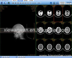 medical x ray dry film