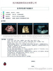 medical dry film,x-ray film,CT film,dry film,digital dry film