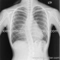 Medical image ,medical dry film,x ray dry film,CT film