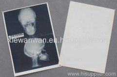 medical x ray film