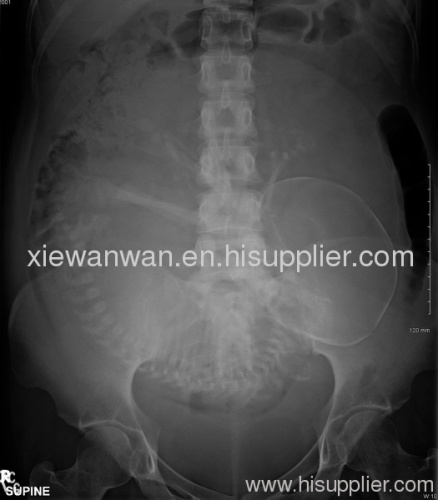 medical dry film,medical x ray film,x-ray film,thermal imager