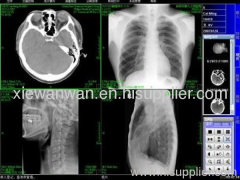 Medical image film,CT film,DR film,MRI film