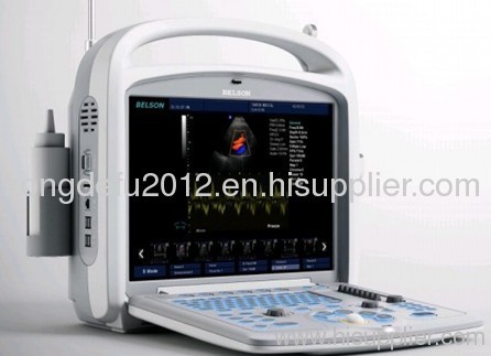 Color Doppler