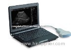 3000 Laptop Full Digital Ultrasound Scanner