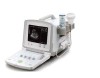 256 Scale B-Ultrasound Diagnostic Scanner