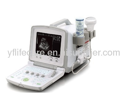 256 Scale B-Ultrasound Diagnostic Scanner