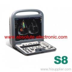 Sonoscape S8 portable Ultrasound