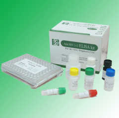 HIV elisa diagnostic kit