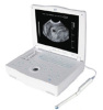 Ultrasound Scanner