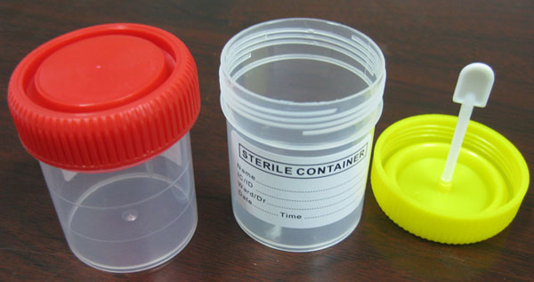 Sterile Specimen Container Stool Container cup