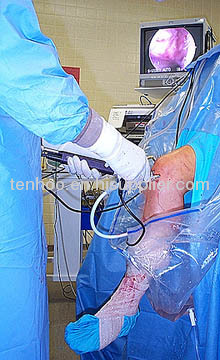 Knee Arthroscopy Drape