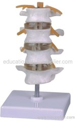 Lumber Vertebra Model