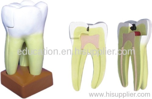 Model of Teeth