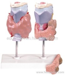 Model of Thyroid Disease