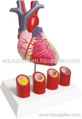 Human Heart Model