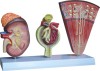 Model of KIdney, Nephron and Glomerulus