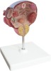 Model of Bladder and Prostate Pathology