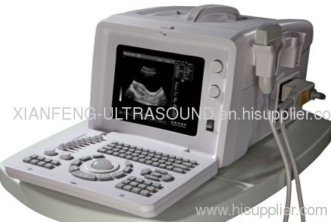 XF218 Portable Ultrasound Scanner