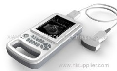 Handheld Ultrasound Scanner