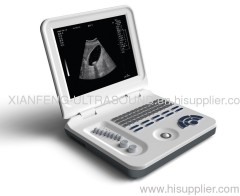 Notebook Ultrasound Scanner