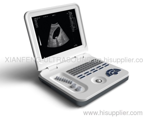 XF30 Ultrasound Scanner