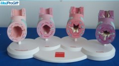 4 parts Bronchial model