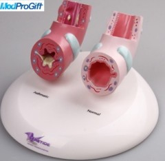 medical teaching Bronchial model