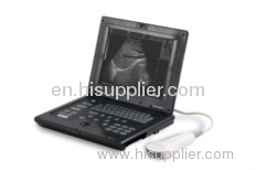 Notebook ultrasound scanner NDP