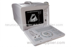 Full Digital Ultrasound Diagnostic System