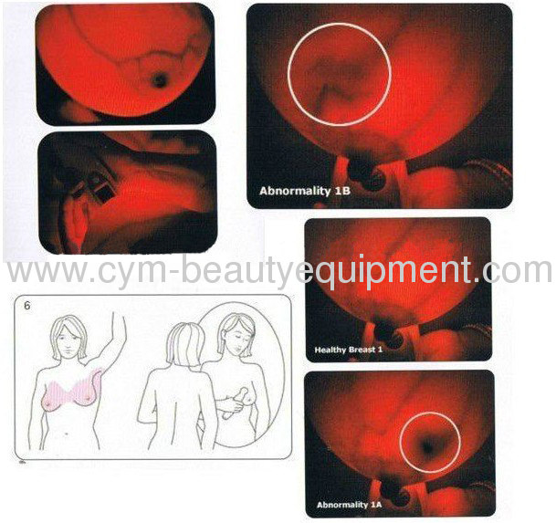 portable breast care detector