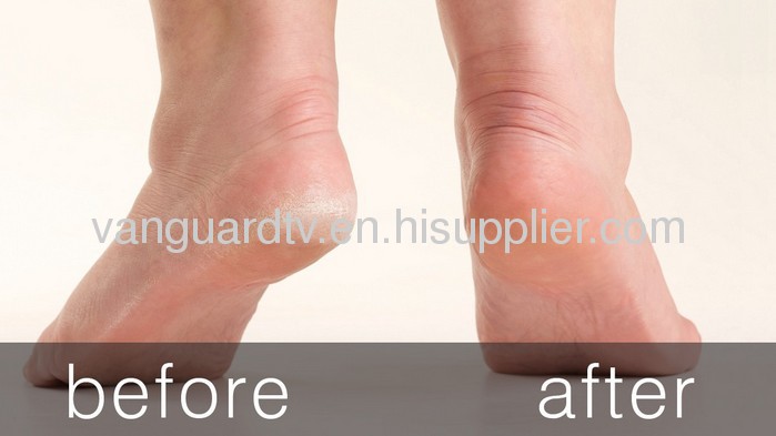 heel smoother / healthy heel / Exfoliating