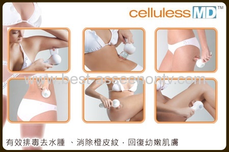 hot sale celluless body beauty MDCelluslim Vacuum Body Massager anticellulitis as seen on tv