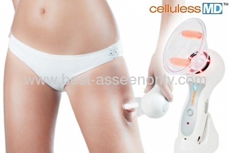 hot sale celluless body beauty MDCelluslim Vacuum Body Massager anticellulitis as seen on tv