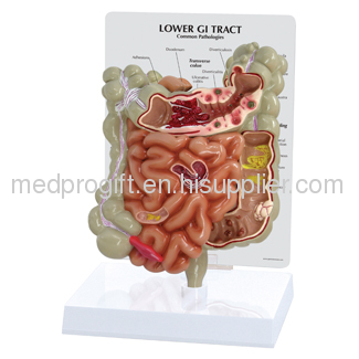 Human GI Tract Model 