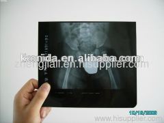 Medical Dry Film ,X ray film,digital film,medical dry x ray film