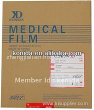 Medical Dry Film ,X ray film,agfa medical film,x ray film dry