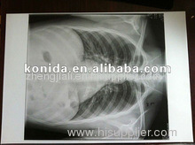 Dry fuji medical x-ray film,blue dry film,digital film