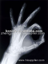 Medical films for Radiology ,hot sex film,medical laser printer