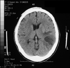 medical ct scan films