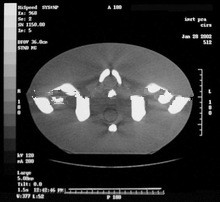 medical xray film ct scan film MRI film