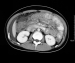 medical xray film ct scan film MRI film