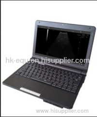 Ultrasound scanner.laptop ultrasound scanner,B-Ultrasound