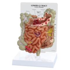 Human GI Tract Model